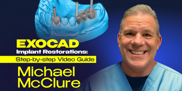 EXOCAD Implant Restorations: Step‑by‑Step Video Guide