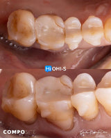 The Biomimetic Concept: Composite Restoration Protocols