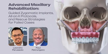 Advanced Maxillary Rehabilitation: Zygomatic Implants, All‑on‑X Protocols and Rescue Strategies