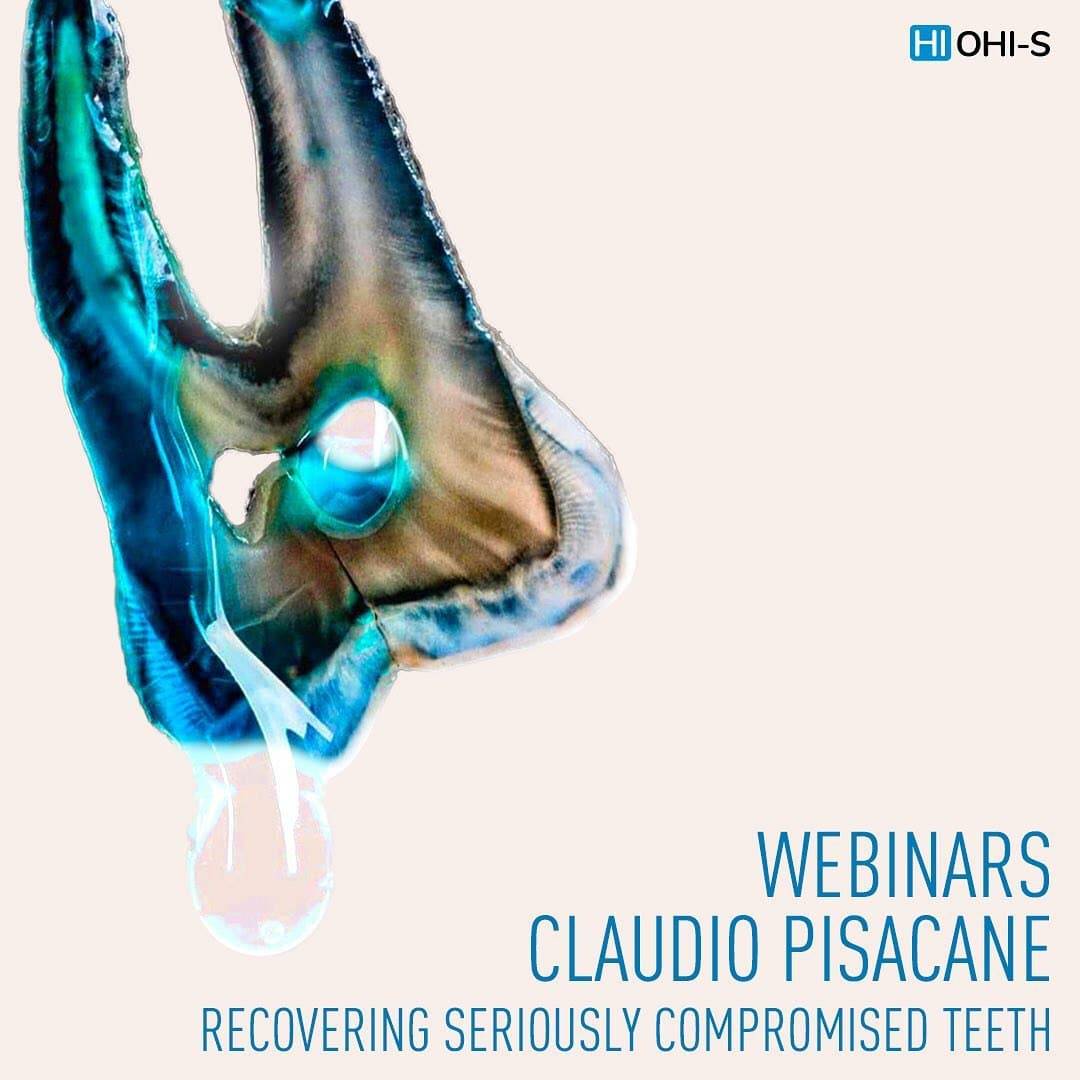 Endodontics and restorative dentistry in Claudio Pisacane's webinars