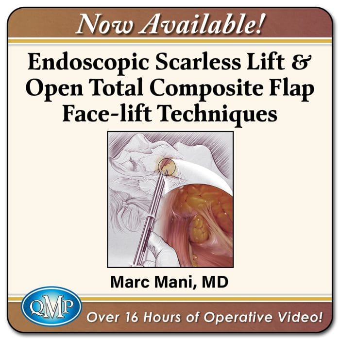 Endoscopic Scarless Lift & Open Total Composite Flap Face-lift Techniques