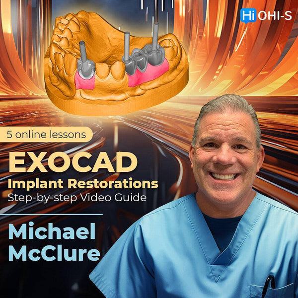 EXOCAD Implant Restorations: Step-by-step Video Guide 2023