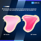 Predictable Sinus Lift