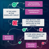 Apical Surgery: For Endodontists and Surgeons