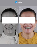 Centric Relation: All Methods of Registration and Clinical Application