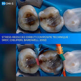 The Biomimetic Concept: Composite Restoration Protocols