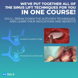 Predictable Sinus Lift