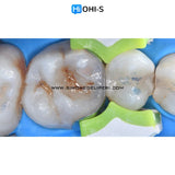 The Biomimetic Concept: Composite Restoration Protocols