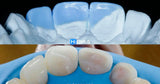 International Schools Working with Composite Restorations