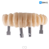 All‑Digital Workflow: Protocols for Flawless Indirect Restorations