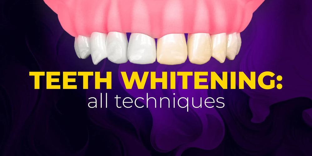 Teeth whitening: all techniques