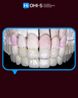 Ceramic Layering: Protocols from the World's Leading Schools