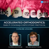 Accelerated Orthodontics: Baruti‑Demiraqi Corticotomy Protocol