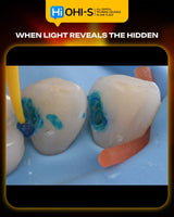 International Schools Working with Composite Restorations