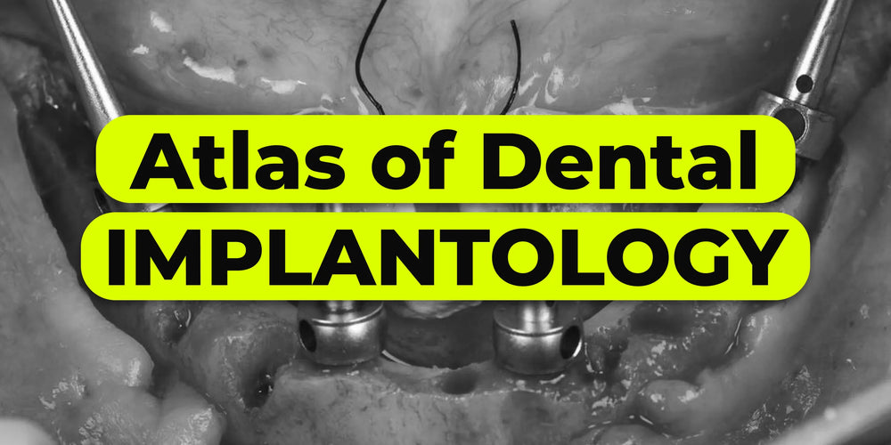 Atlas of Dental Implantology. Mastering Extreme Cases with Advanced Materials and Protocols