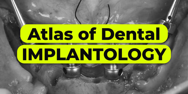 Atlas of Dental Implantology. Mastering Extreme Cases with Advanced Materials and Protocols