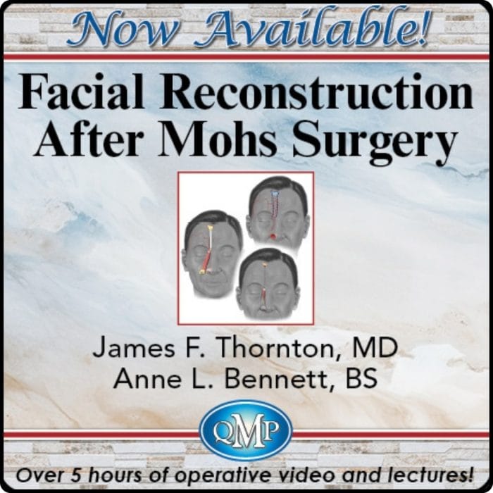 Facial Reconstruction After Mohs Surgery 2024