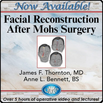 Facial Reconstruction After Mohs Surgery 2024