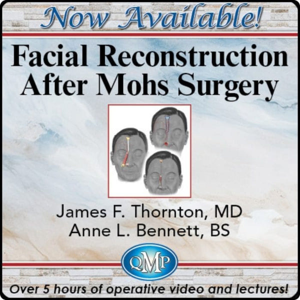 Facial Reconstruction After Mohs Surgery 2024