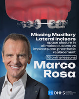 Missing Maxillary Lateral Incisors: Space Closure in All Malocclusions vs. Implants and Prosthetic Replacement