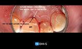 Advanced Periodontology: Surgical Protocols