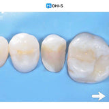 The Biomimetic Concept: Composite Restoration Protocols