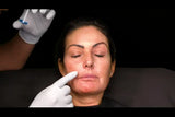 Botox and filler online course - RA Summit 2024