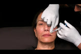 Botox and filler online course - RA Summit 2024