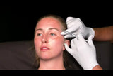 Botox and filler online course - RA Summit 2024