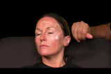 Botox and filler online course - RA Summit 2024