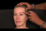 Botox and filler online course - RA Summit 2024