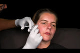 Botox and filler online course - RA Summit 2024