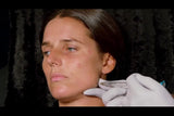 Botox and filler online course - RA Summit 2024