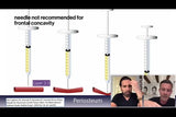 Botox and filler online course - RA Summit 2024