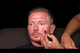 Botox and filler online course - RA Summit 2024