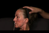 Botox and filler online course - RA Summit 2024
