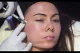 Botox and filler online course - RA Summit 2024