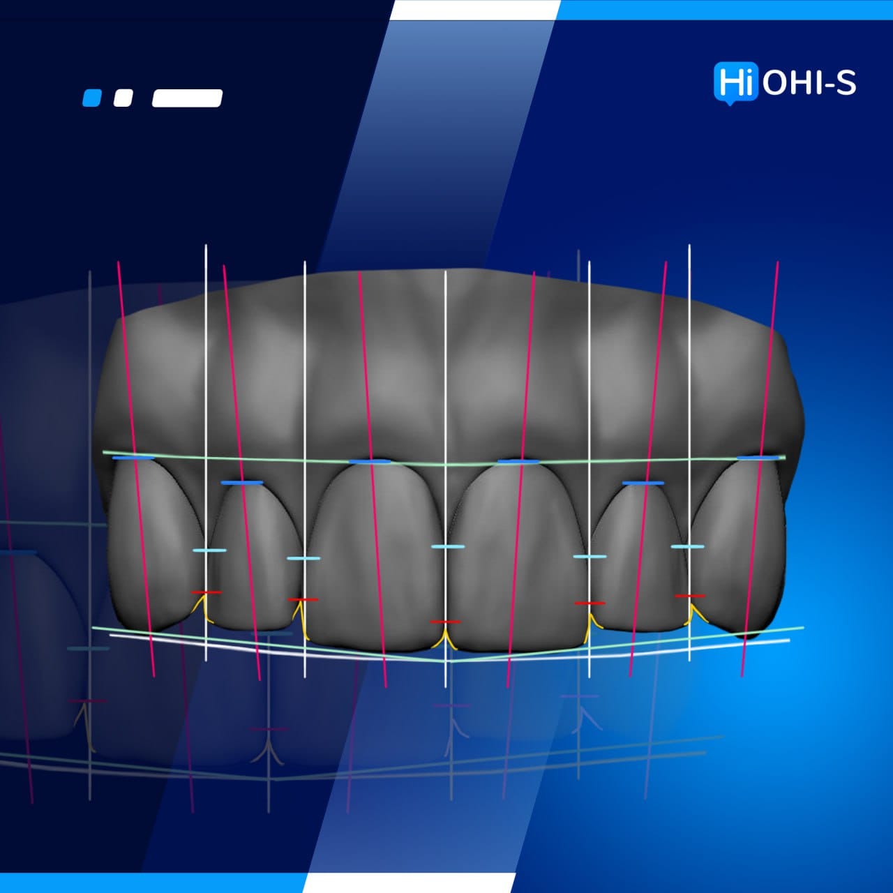 full rehabilitation in prosthetic dentistry - Mauro Fradeani