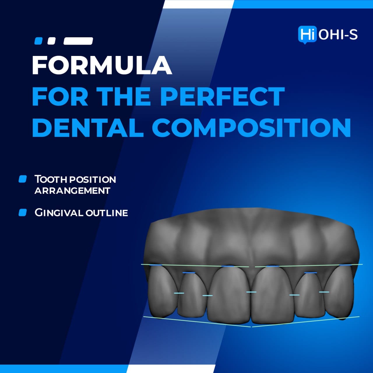 full rehabilitation in prosthetic dentistry - Mauro Fradeani