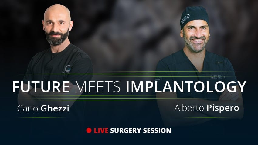Future Meets Implantology  Live Surgery Session - English Narration