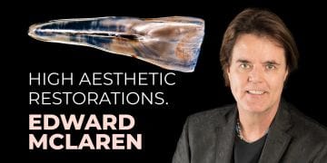 High aesthetic restorations