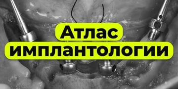Implantology Atlas: Management of Extreme Cases Using Advanced Materials and Protocols