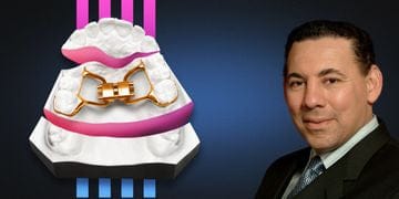 Interceptive orthodonticsFunctional orthodontics. Autotransplantation. Result retention