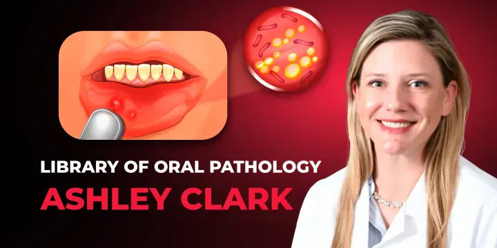 Library of Oral Pathology: Management of Precancerous and Cancerous Oral Lesions