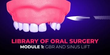 Library of Oral Surgery. Module 1: GBR and Sinus Lift