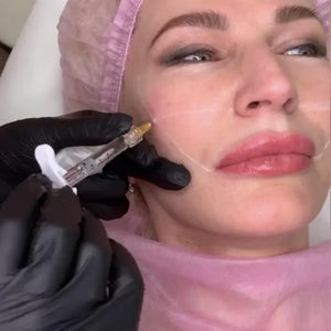 LIPS FOR KISS DIAMOND PACK - THE ULTIMATE AESTHETIC MASTERY COLLECTION