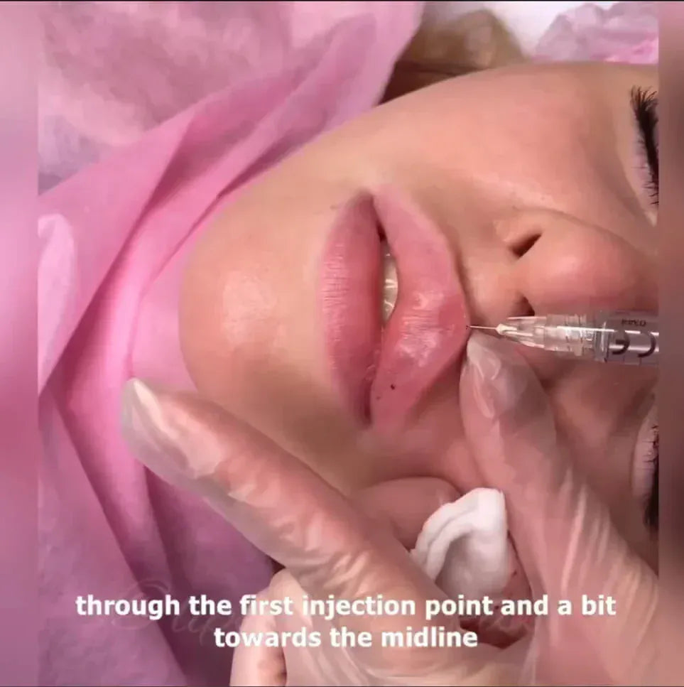 LIPS FOR KISS DIAMOND PACK - THE ULTIMATE AESTHETIC MASTERY COLLECTION