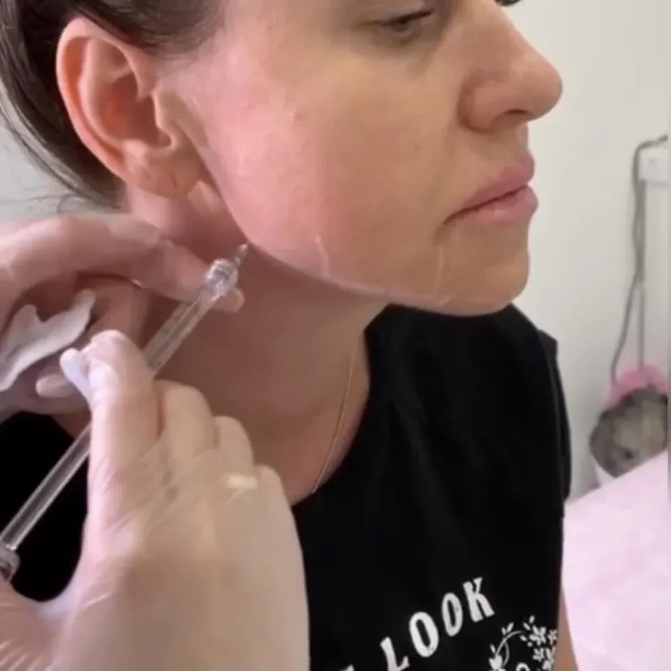 LIPS FOR KISS DIAMOND PACK - THE ULTIMATE AESTHETIC MASTERY COLLECTION