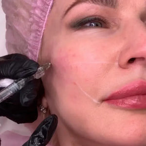 LIPS FOR KISS DIAMOND PACK - THE ULTIMATE AESTHETIC MASTERY COLLECTION