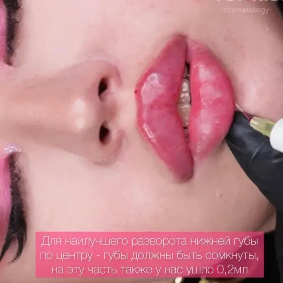 LIPS FOR KISS DIAMOND PACK - THE ULTIMATE AESTHETIC MASTERY COLLECTION